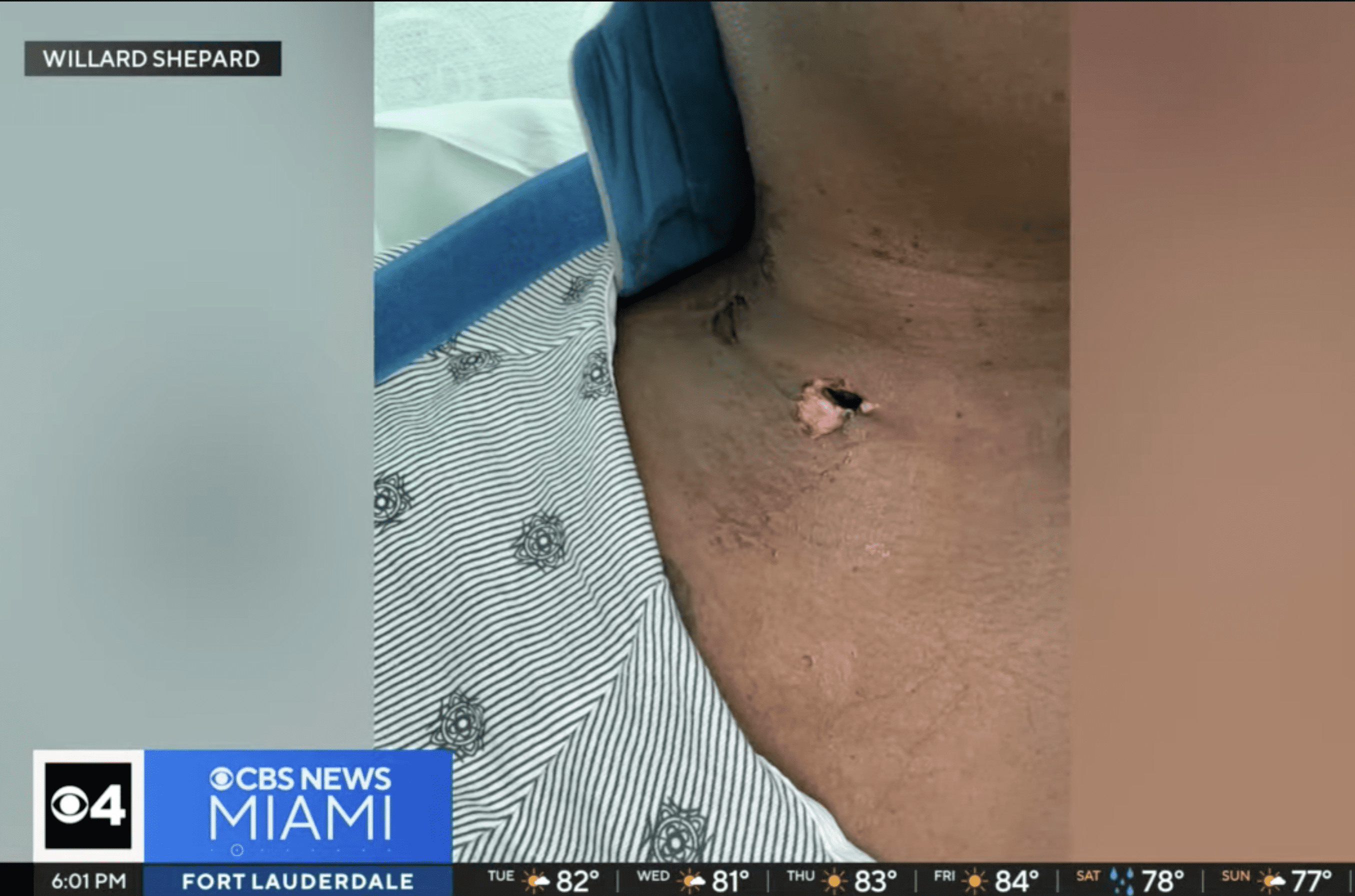 shot in the neck